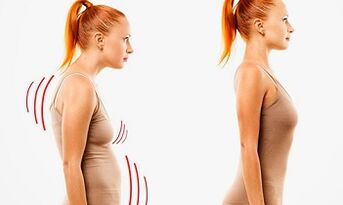 Reason -As the development of cervical osteochondrosis
