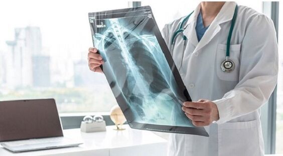 X-ray diagnostics for pain under the left shoulder blade