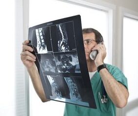 Myelography for the diagnosis of osteochondrosis and intervertebral hernia